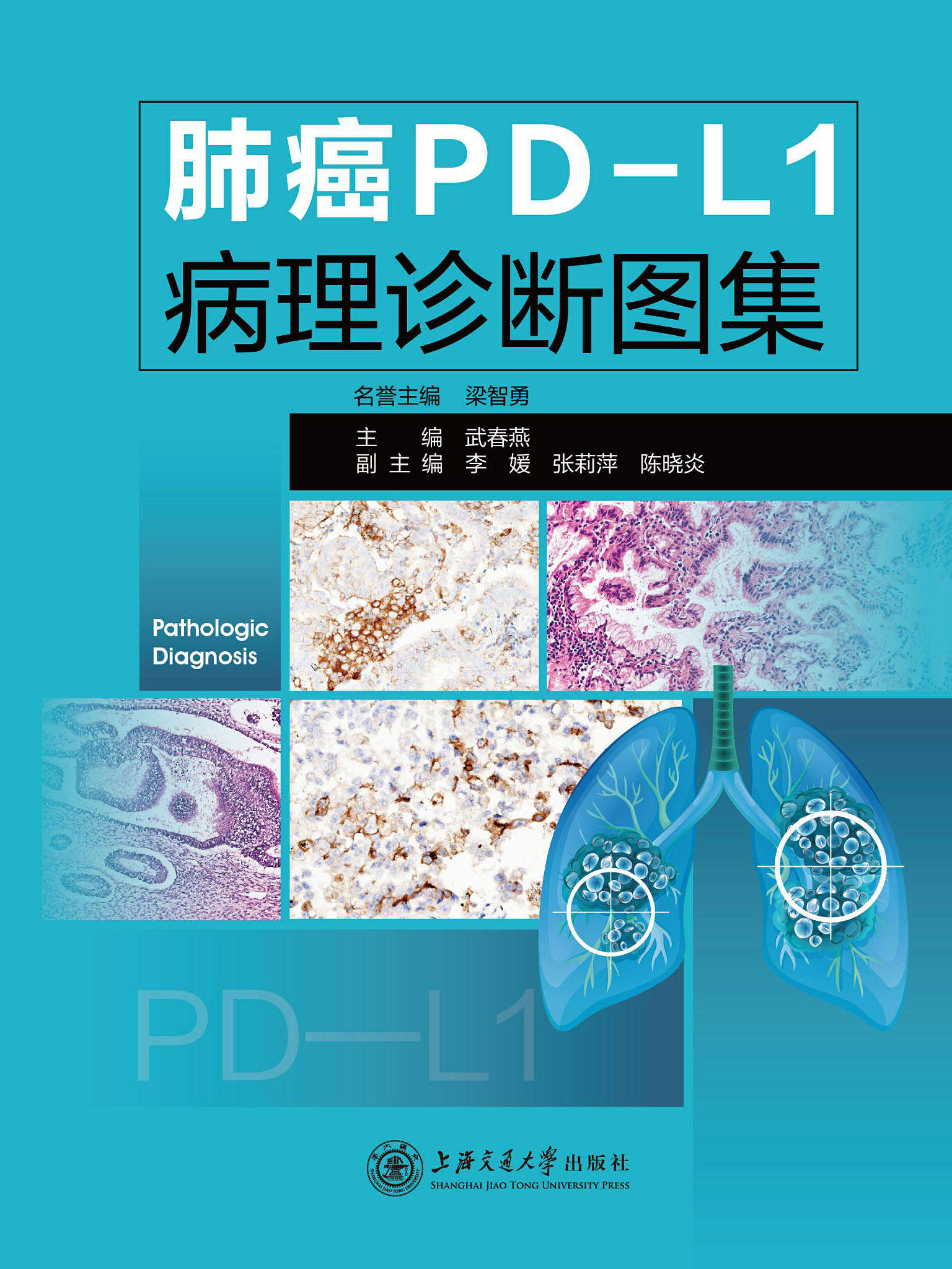 肺癌PD-L1病理诊断图集